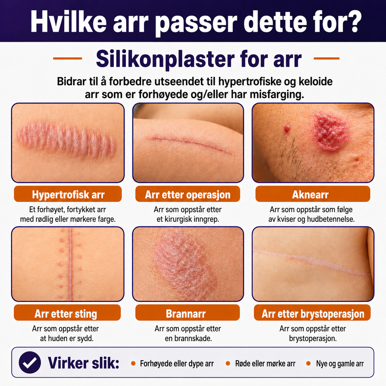Silikonplaster for arr – Medisinsk kvalitet